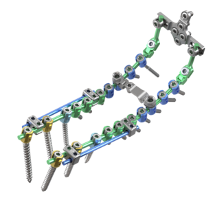 © ulrich medical. All rights reserved. Use, reproduction or transfer without express authorization is not permitted.