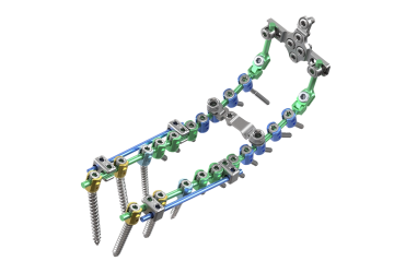 © ulrich medical. All rights reserved. Use, reproduction or transfer without express authorization is not permitted.