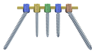 © ulrich medical. All rights reserved. Use, reproduction or transfer without express authorization is not permitted.