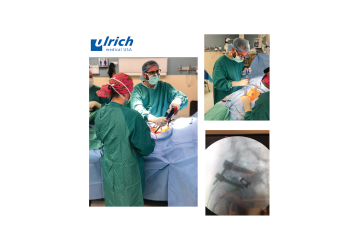 © ulrich medical. All rights reserved. Use, reproduction or transfer without express authorization is not permitted.