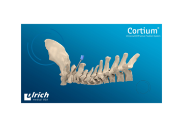 © ulrich medical. All rights reserved. Use, reproduction or transfer without express authorization is not permitted.