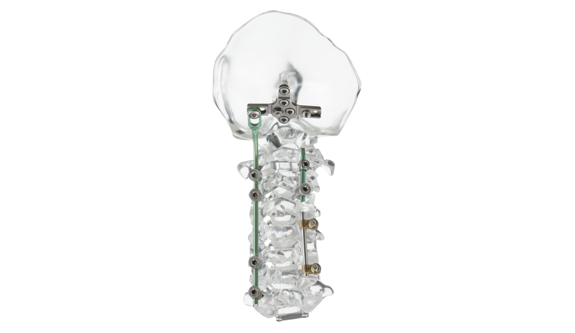 © ulrich medical. All rights reserved. Use, reproduction or transfer without express authorization is not permitted.