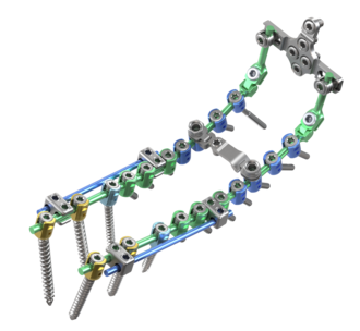 © ulrich medical. All rights reserved. Use, reproduction or transfer without express authorization is not permitted.