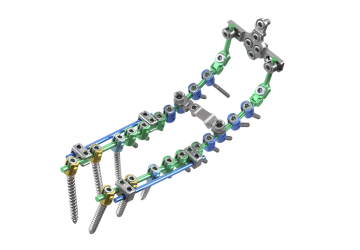 © ulrich medical. All rights reserved. Use, reproduction or transfer without express authorization is not permitted.