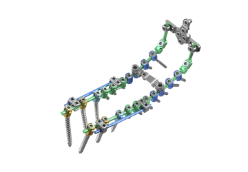 © ulrich medical. All rights reserved. Use, reproduction or transfer without express authorization is not permitted.