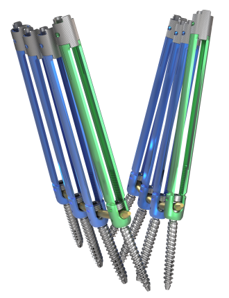 © ulrich medical. All rights reserved. Use, reproduction or transfer without express authorization is not permitted.