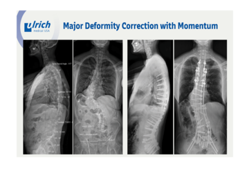 © ulrich medical. All rights reserved. Use, reproduction or transfer without express authorization is not permitted.