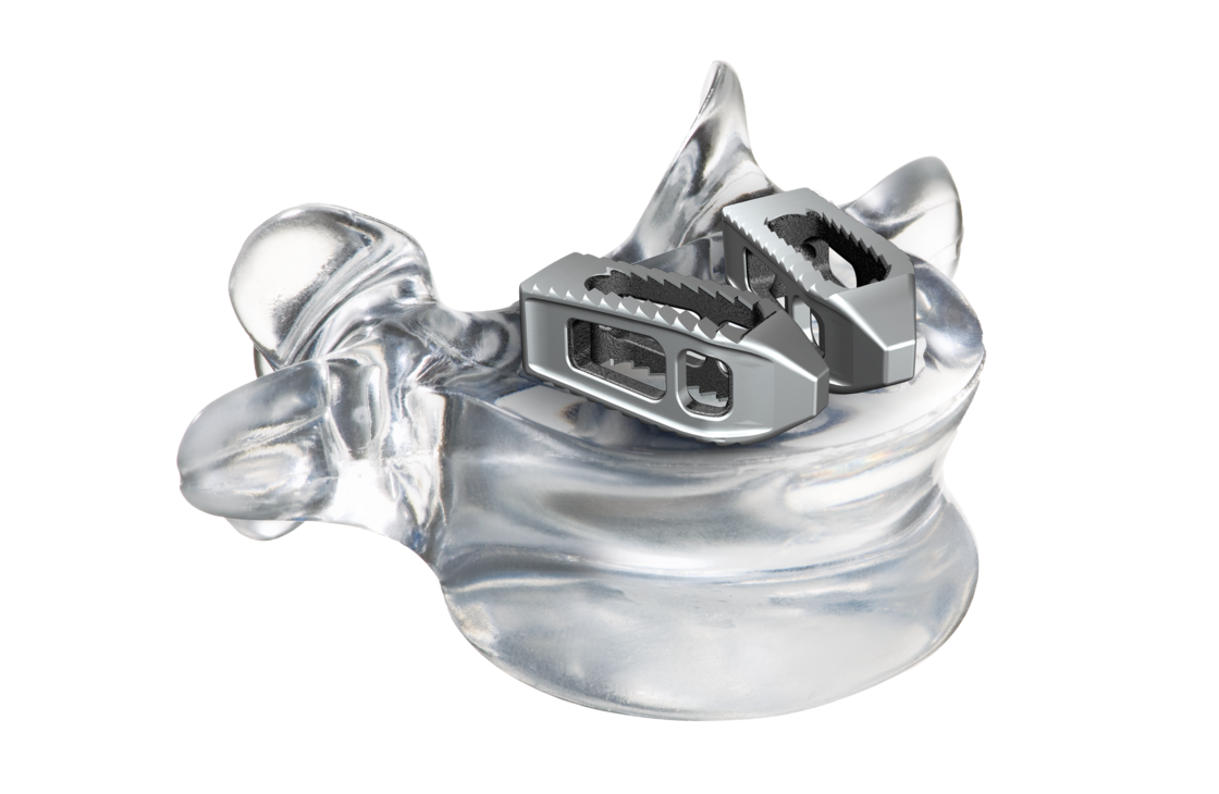 © ulrich medical. All rights reserved. Use, reproduction or transfer without express authorization is not permitted.